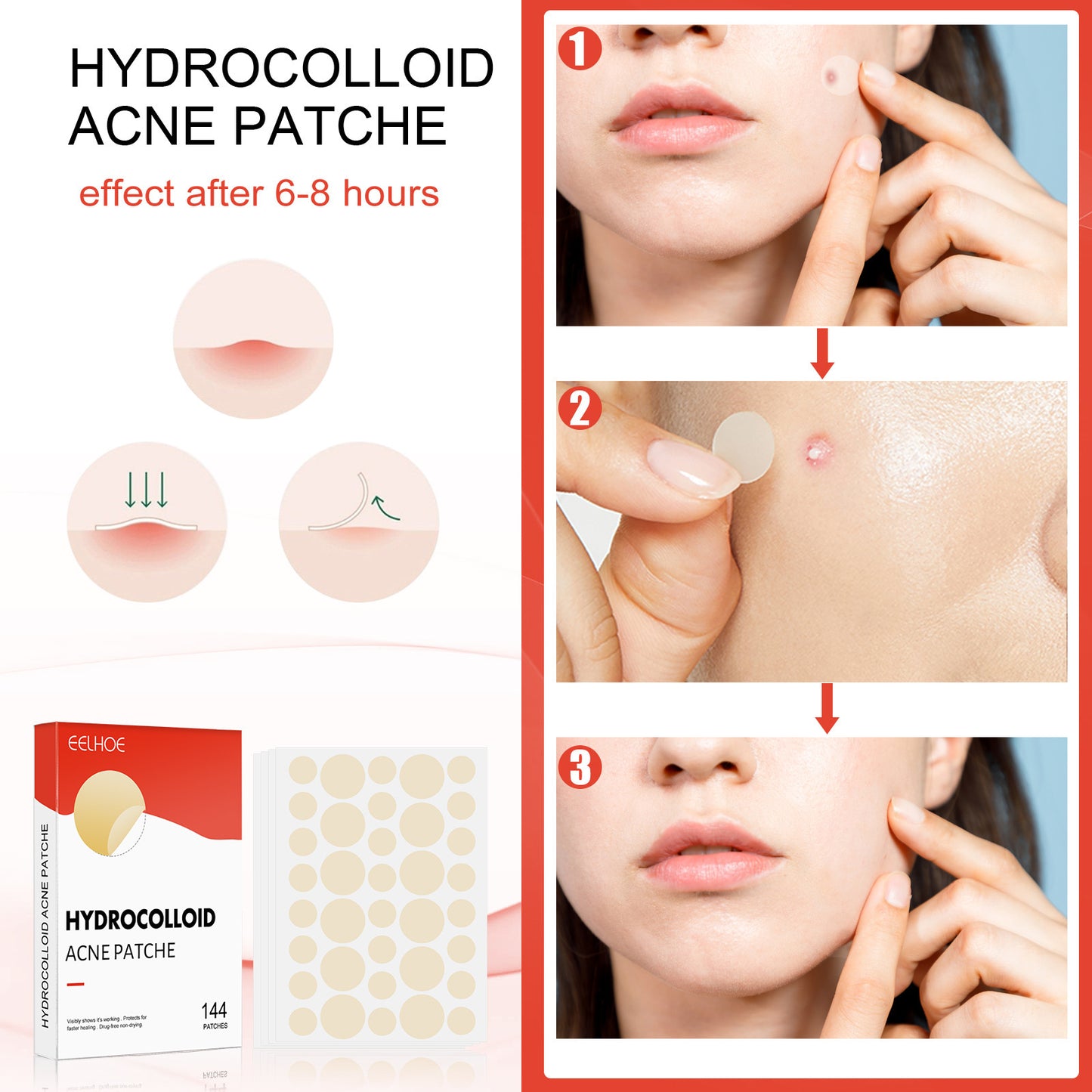 Parche de maquillaje invisible hidrocoloide EELHOE para el acné, 144 piezas