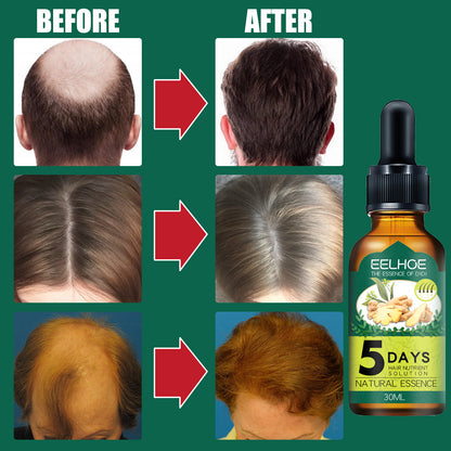 EELHOE Ginger Hair Care Essential Oil - Anti-Hair Loss Treatment