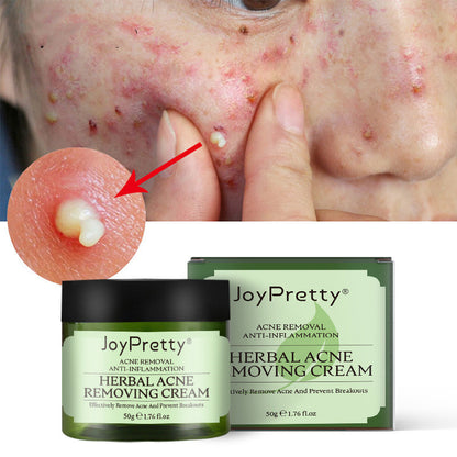 JoyPretty Herbal Acne Cream For Reducing Acne Marks