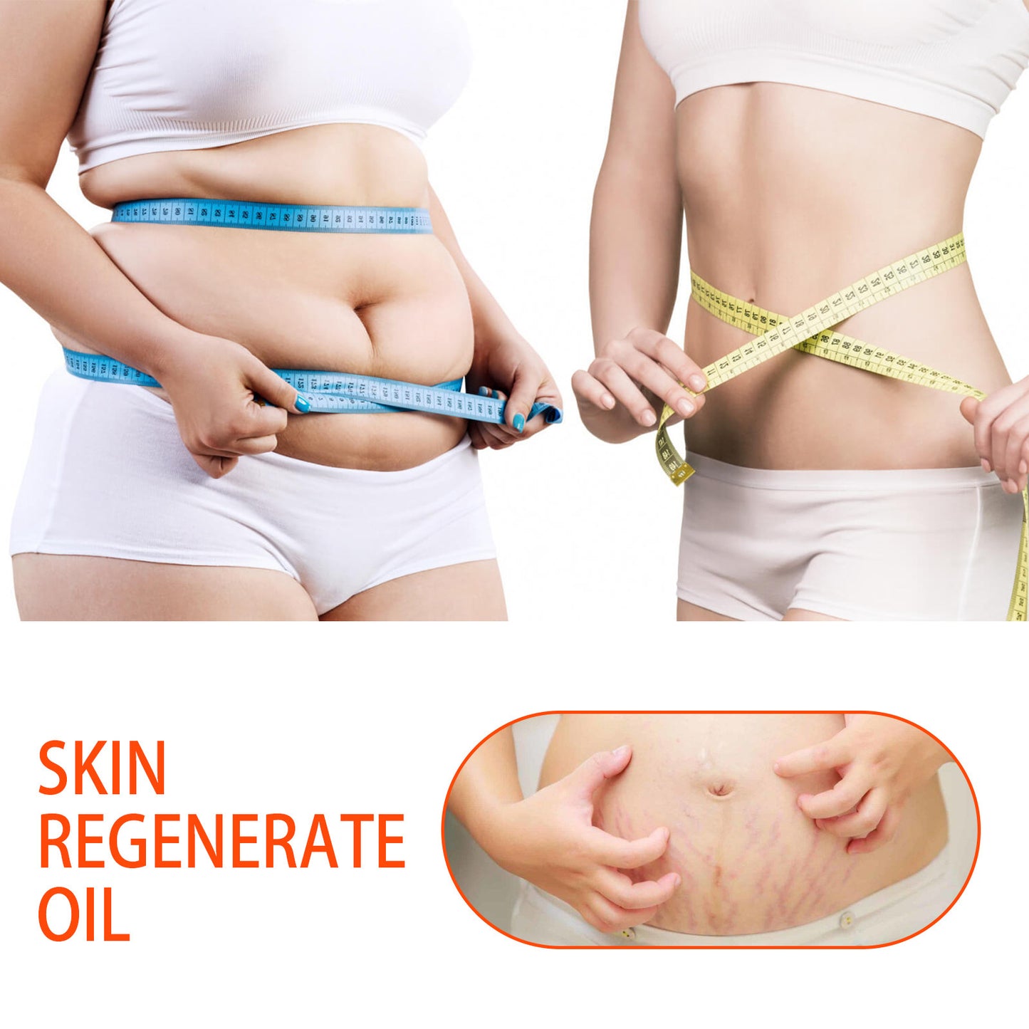 Scar Recovery Oil Fade Abdomen Pregnancy and Postpartum Stretch Mark and Scar Remover, Fat Burner, Waist Slimming Oil