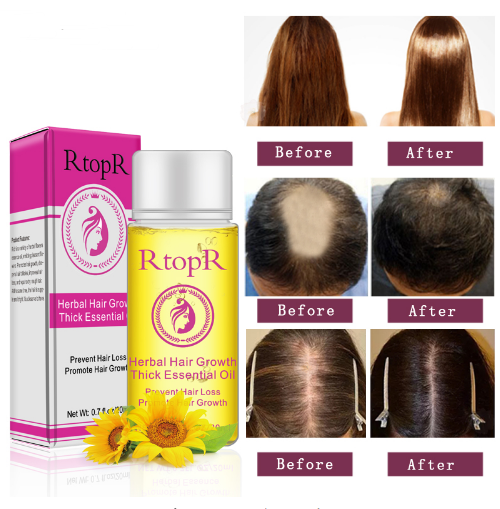 RTOPR Essential Oil Liquid for Rapid Hair Growth and Hair Loss Prevention 20ml