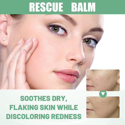 EELHOE Blemish, Acne, Pimple and Blackhead Gel