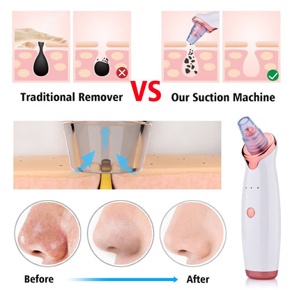 Microcrystailline Blackhead Removal Instrument Electric Suction, Face Wash, Acne Removal Device