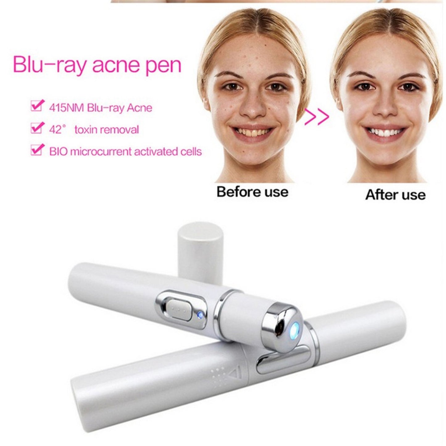 Blue Light Blue Light Therapy Acne Laser Pen, Wrinkle Removal Device