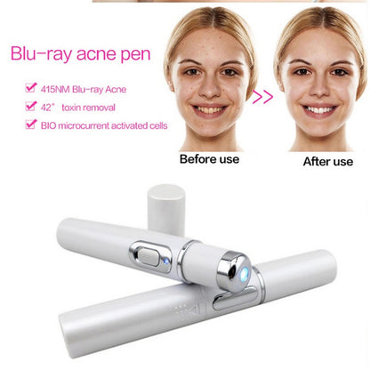 Blue Light Blue Light Therapy Acne Laser Pen, Wrinkle Removal Device