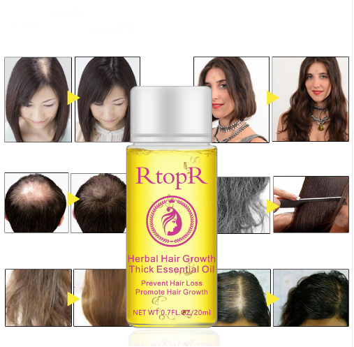 RTOPR Essential Oil Liquid for Rapid Hair Growth and Hair Loss Prevention 20ml