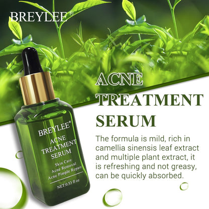 BREYLEE Acne Treatment Serum - Anti Acne Scar Removal Cream Skin Care Whitening Repair Acne Remover