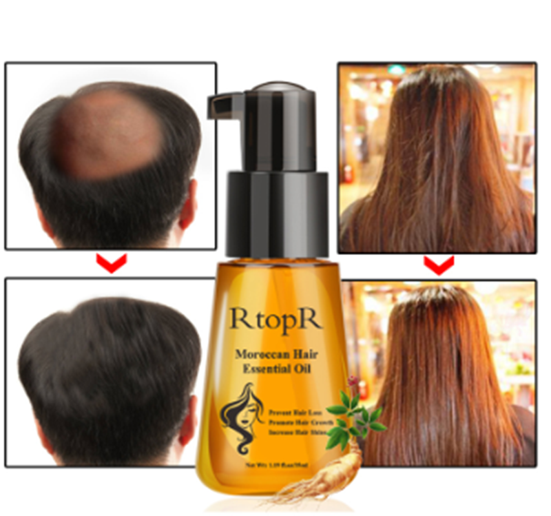 RTOPR Moroccan Essence Hair Serum (Unisex) 35ml - Anti-Hair Loss Treatment - Buy 3, Pay For 2