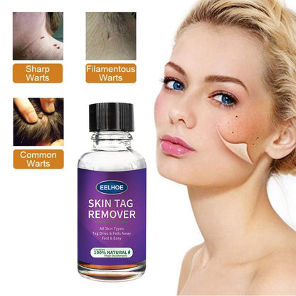 Eelhoe Skin Verrucous Remover To Solve Skin Verrucous