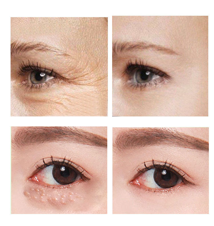 Crema para ojos antiarrugas VOVA, eliminadora de ojeras y bolsas