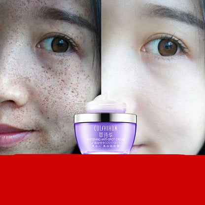 CUISHIHUA Whitening Freckle Cream 30g