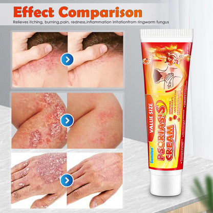 SUMIFUN Psoriasis Plaster & Ringworm King Skin Itch Relief Cream for External Use - Hair Loss and Psoriasis Cream