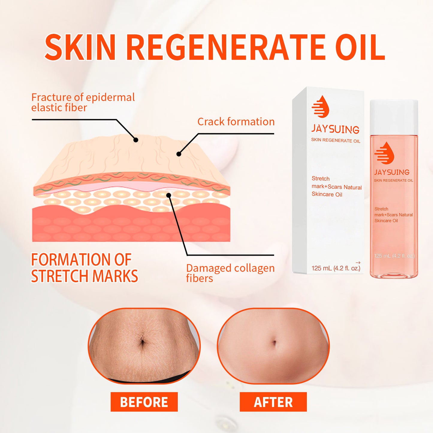 Scar Recovery Oil Fade Abdomen Pregnancy and Postpartum Stretch Mark and Scar Remover, Fat Burner, Waist Slimming Oil