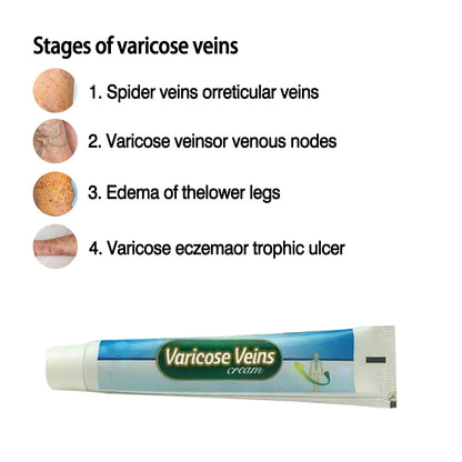 JAYSUNG Varicose Vein Cream - Buy 3, Pay For 2