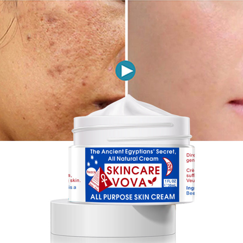 VOVA New Firming Magic Cream 30ml – Reduces Wrinkles, Fine Lines, and Acne Scars