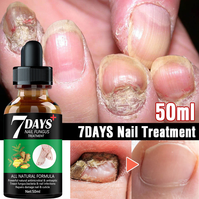 7DAYS Nail Fungus Treatment Serum