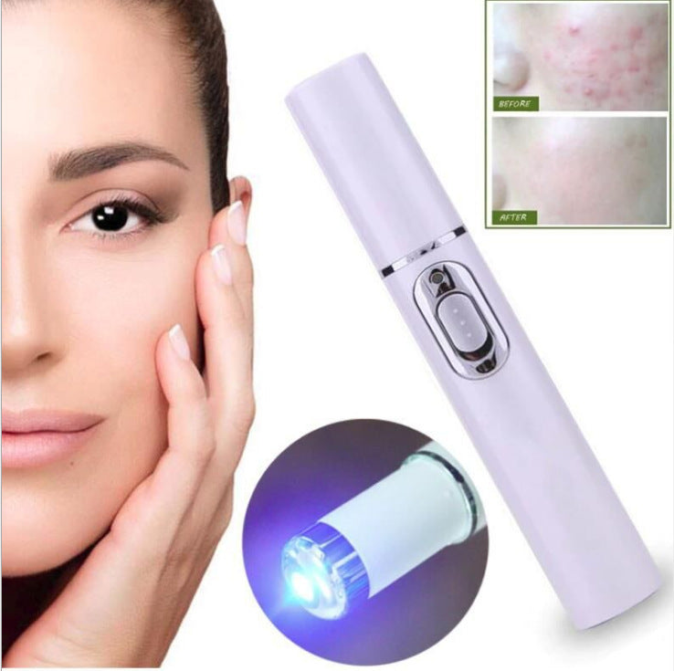 Acne Laser Pen - Wrinkle Removal, Scar, Under-Eye Dark Circles Removal Device