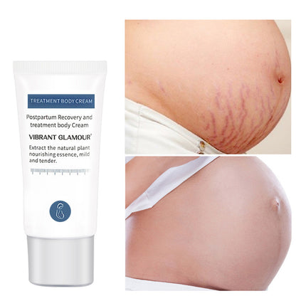 VIBRANT GLAMOUR Pregnancy & Postpartum Stretch Mark Repair and Skin Blemish Removal Cream