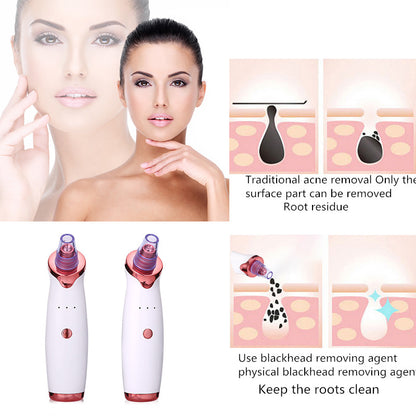 Blackhead Removal, Acne Vacuum, Pore Cleaner