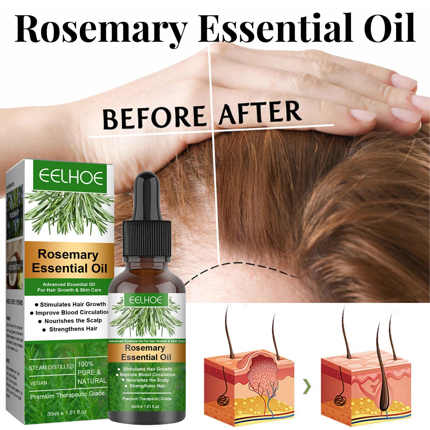 EELHOE Rosemary Hair Care Essential Oil - Hair Growth Enhancer & Anti-Hair Loss Treatment, Nourishing Scalp and Roots