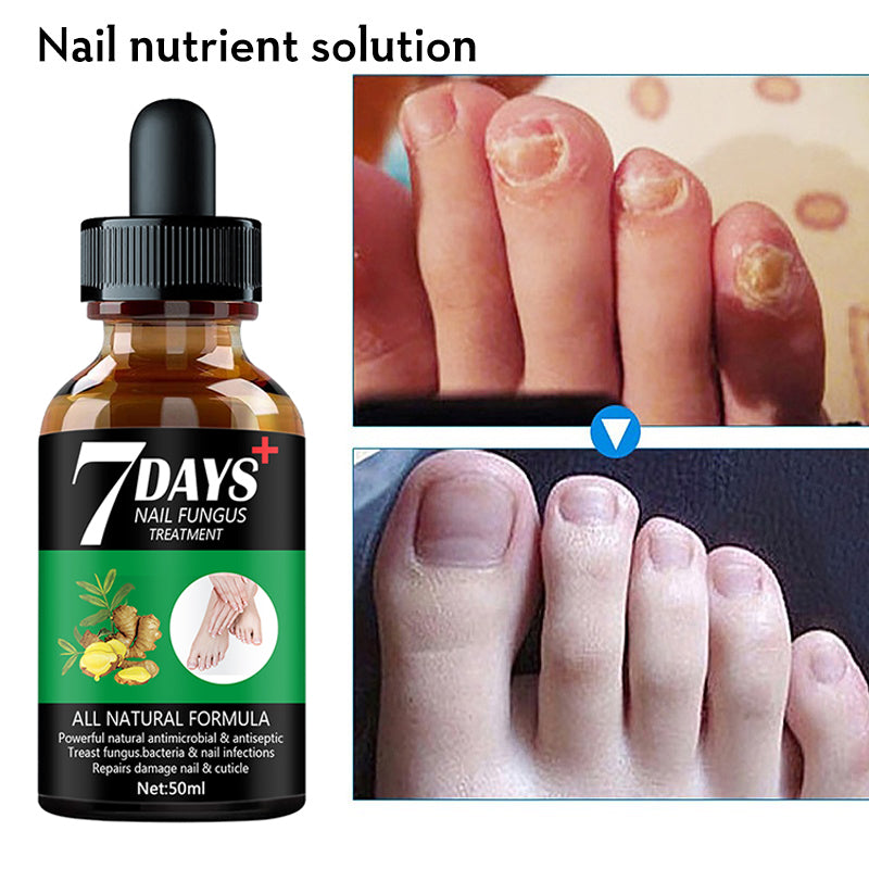 7DAYS Nail Fungus Treatment Serum