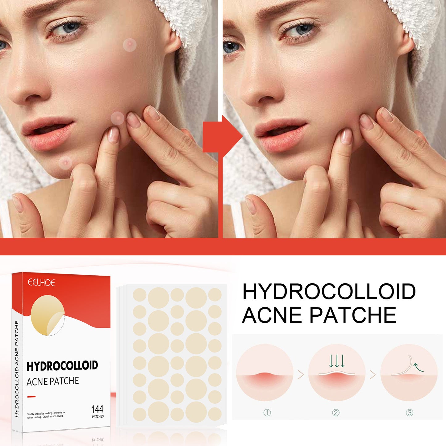 EELHOE Hydrocolloid Invisible Makeup Applicable Acne Patch -144 Pieces