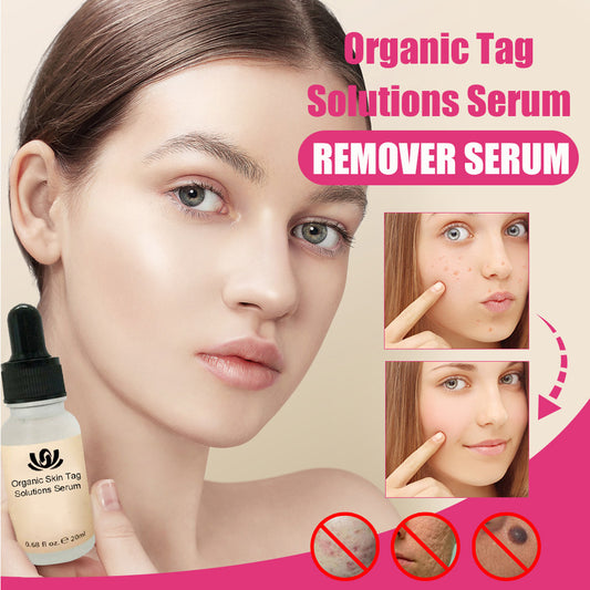 Blemish & Wart & Acne Removal Serum (Organic)