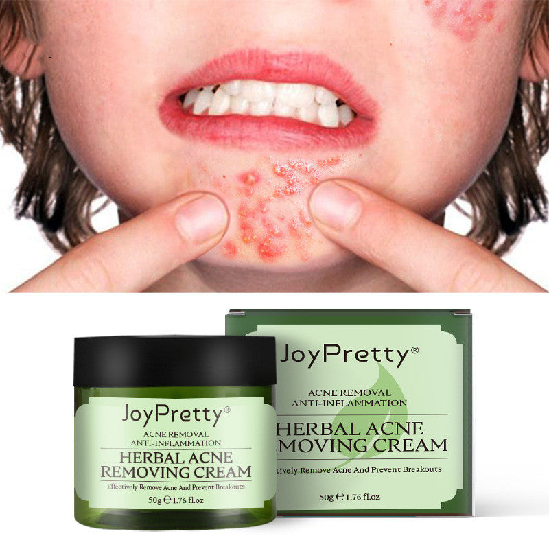 JoyPretty Herbal Acne Cream For Reducing Acne Marks