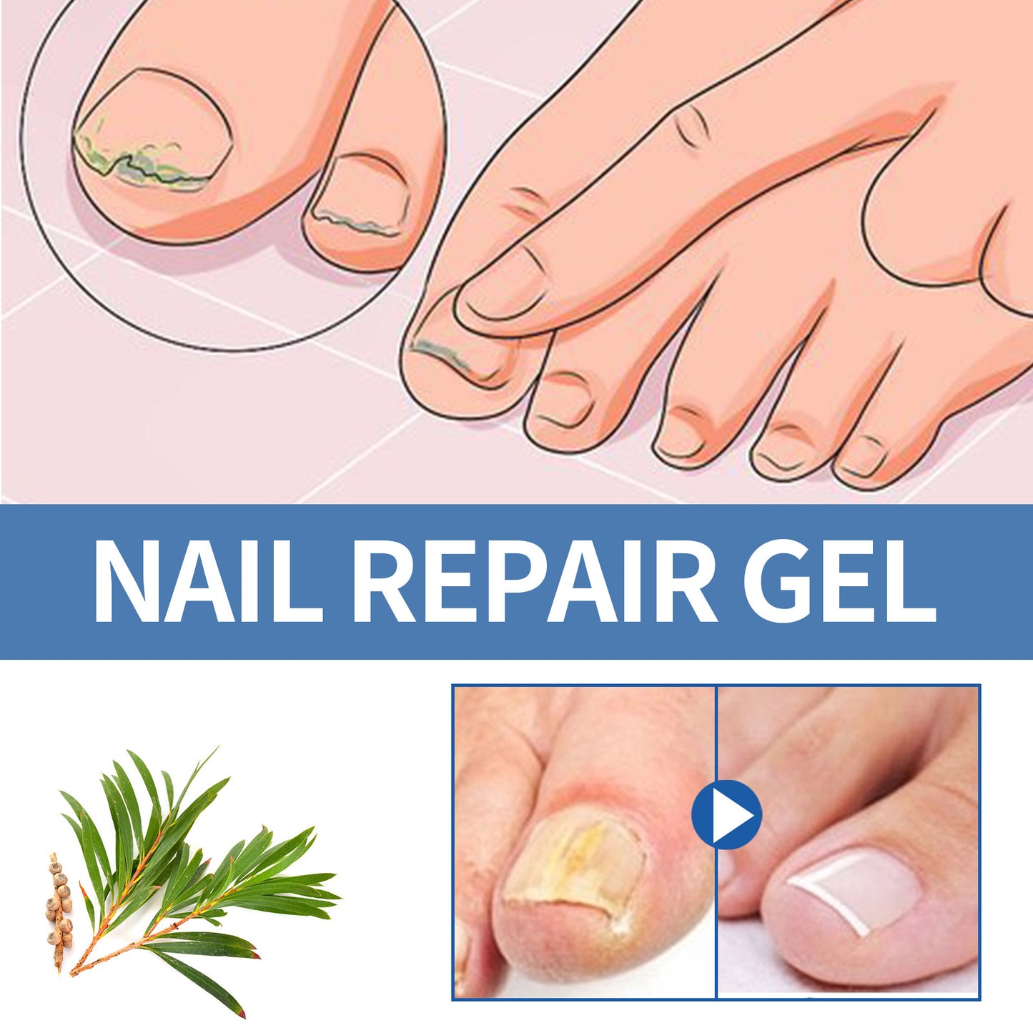 OUHOE Nail Fungus Remover Nail Care Cream