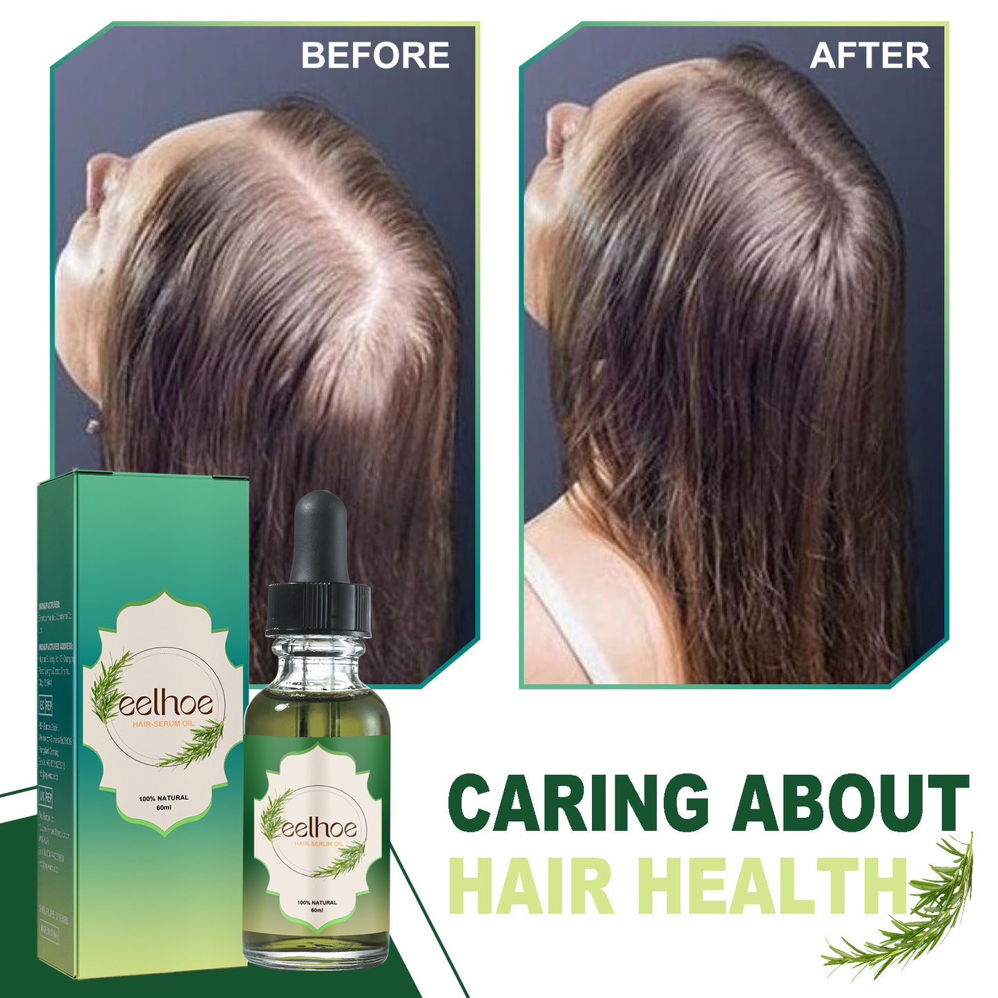 EELHOE Nourishing & Anti-Hair Loss Herbal Serum with Rosemary Oil - 60ml