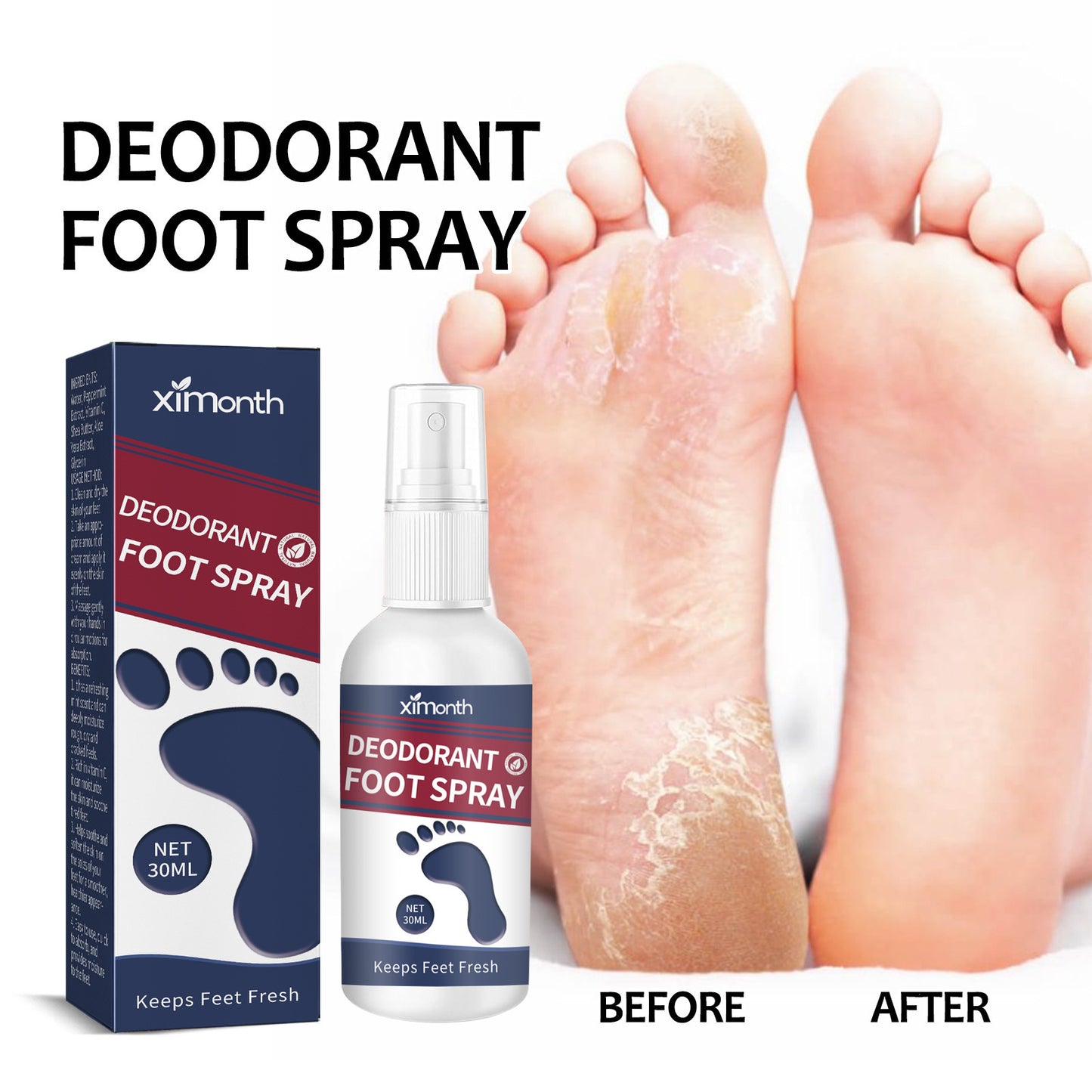 XIMONTH Foot Heel Repair Spray: Anti-Crack and Moisturizing