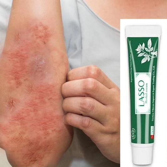 LASSO Herbal Cream - Rash Relief - Buy 3 Pay For 2