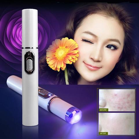 Blue Light Blue Light Therapy Acne Laser Pen, Wrinkle Removal Device