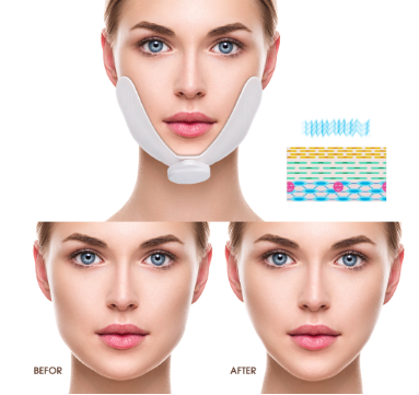 Dispositivo de lifting facial en forma de V para adelgazar el rostro de mujeres