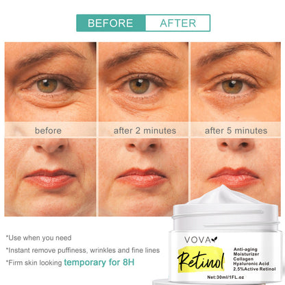 كريم VOVA Retinol المرطب للوجه المضاد للشيخوخة والتجاعيد 30 مل