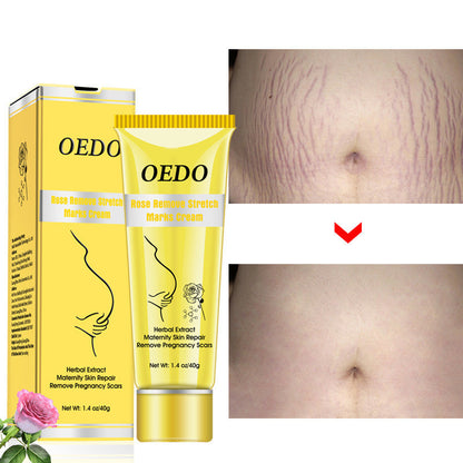 OEDO Smooth and Youthful Skin Anti-Wrinkle Cream for Stretch Marks, Rosacea, and Wrinkles - Oedo Rose Rem Stretch Mark Cream