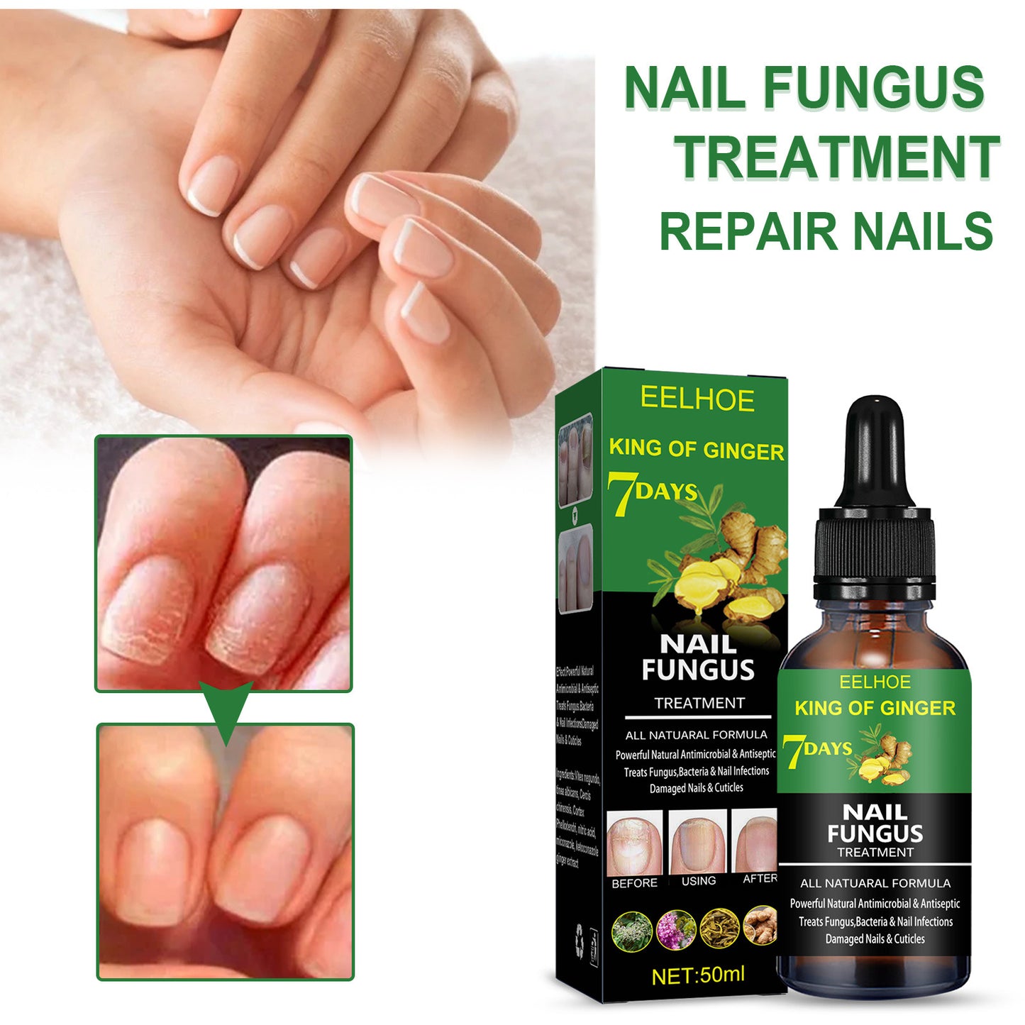 EELHOE Herbal Nail Repair Solution 50ml