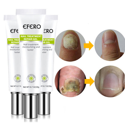 EFERO Anti-Fungal and Nail Care and Repair Serum