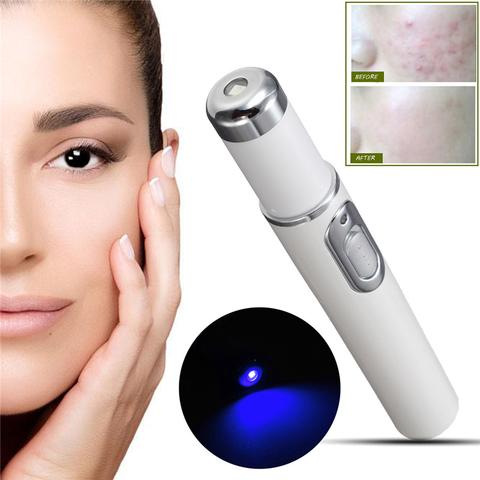 Blue Light Blue Light Therapy Acne Laser Pen, Wrinkle Removal Device