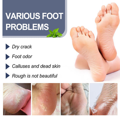 XIMONTH Foot Heel Repair Spray: Anti-Crack and Moisturizing