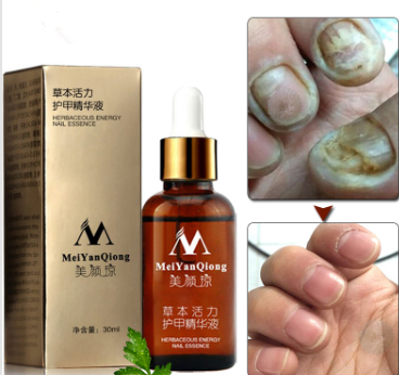 MEIYANQIONG Gel de uñas a base de hierbas antihongos 30g