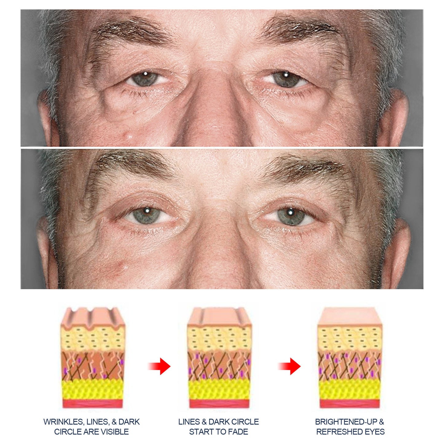 Crema antienvejecimiento para ojos para hombres OPENEYES: compre 3 y pague 2