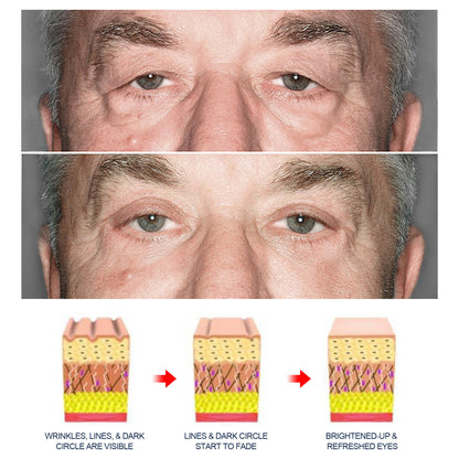 Crema antienvejecimiento para ojos para hombres OPENEYES: compre 3 y pague 2