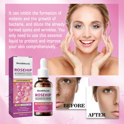 Rose Fruit Skin Rejuvenation Moisturizing Freckle and Spot Remover Toner