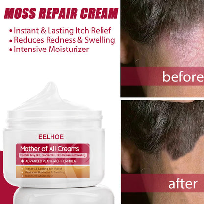 EELHOE Seaweed Skin Repair Cream - Anti-Itch, Moisturizing, Nourishing Heel Crack Treatment, Skin Care