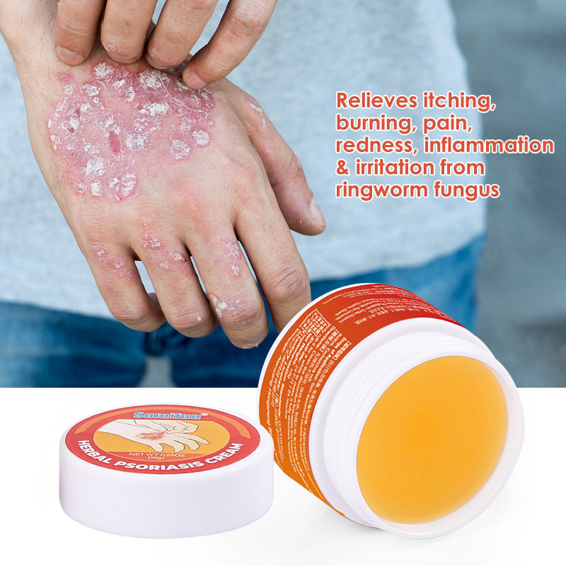 SUMITUN Dermatitis Eczemn Tinea Picazón Crema para psoriasis a base de hierbas