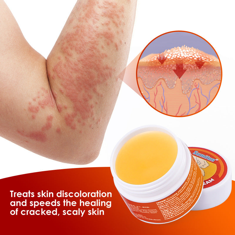 SUMITUN  Dermatitis Eczemn Tinea Itching  Herbal Psoriasis Cream