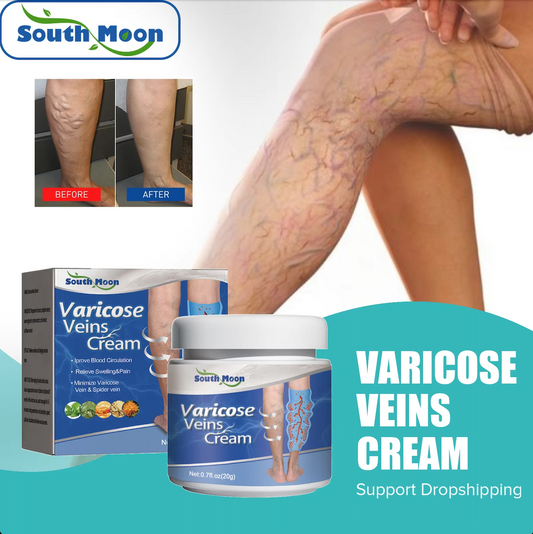 SOUTH MOON Varicose Vein and Leg Pain Relief Ointment, Phlebitis Soothing, Effective Treatment for Vasculitis, Worm and Spider Vein Appearance