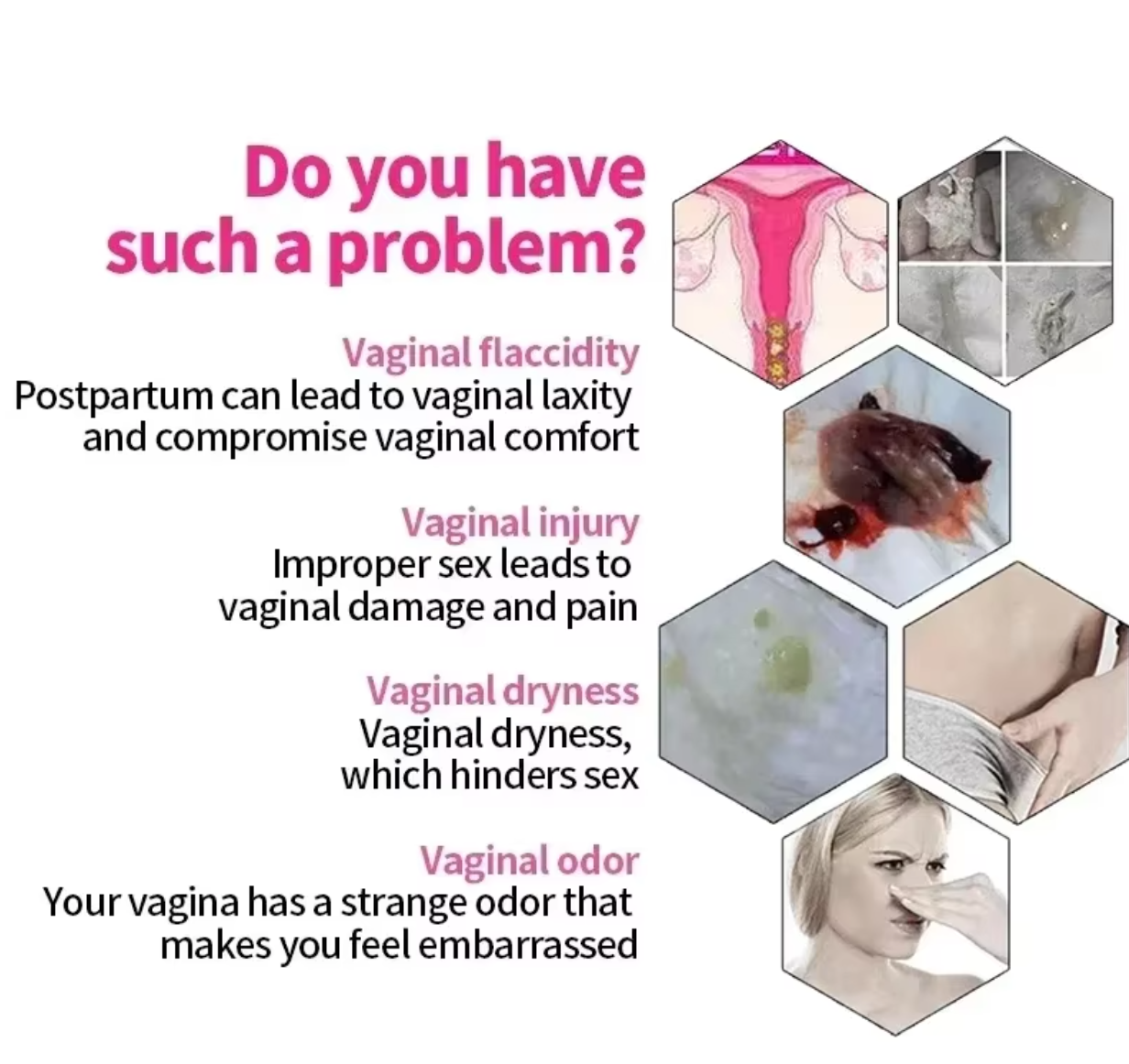 YiLi Vaginal Tightening, Constriction, Gynecological Care, Vaginal Hygiene and Repair Spray and Cream