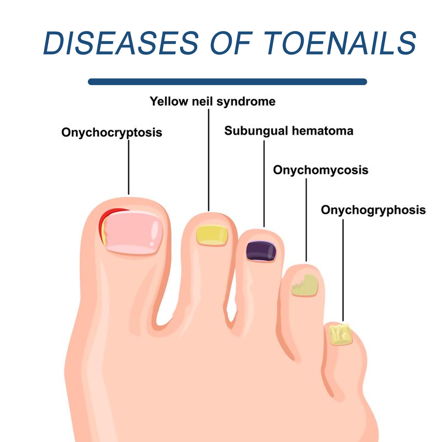 JAYSUING 7 Days Nail and Hand Foot Care